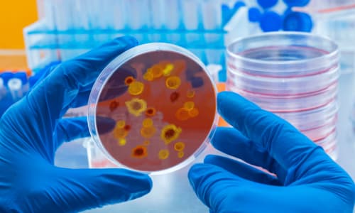 Virus Dengue: Malattia trasmessa dalle zanzare