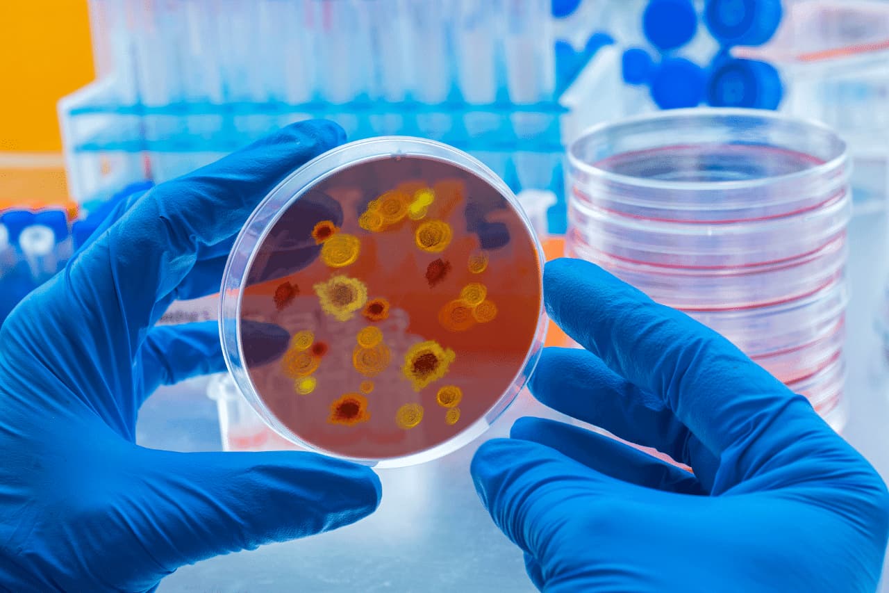Al momento stai visualizzando Virus Dengue: Malattia trasmessa dalle zanzare