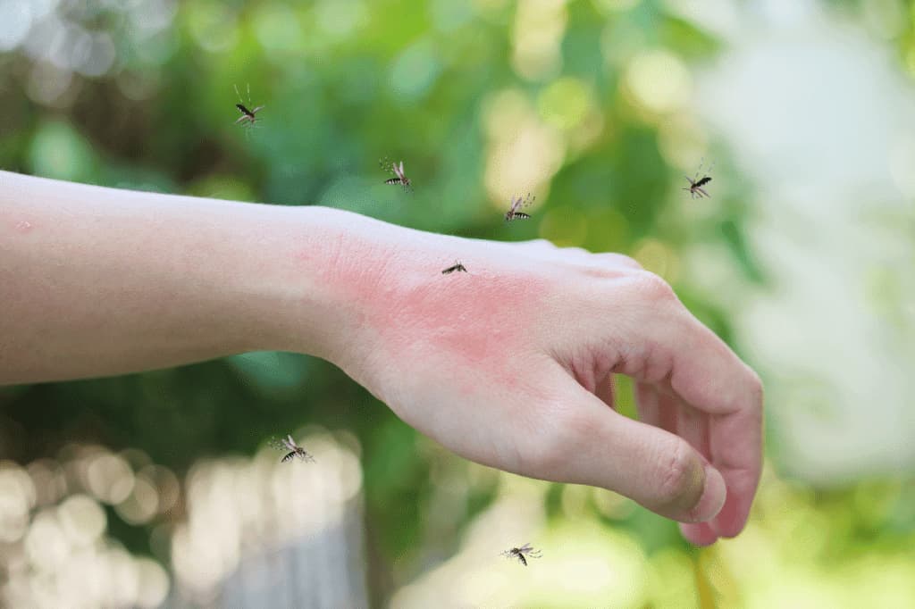 dengue zanzare
