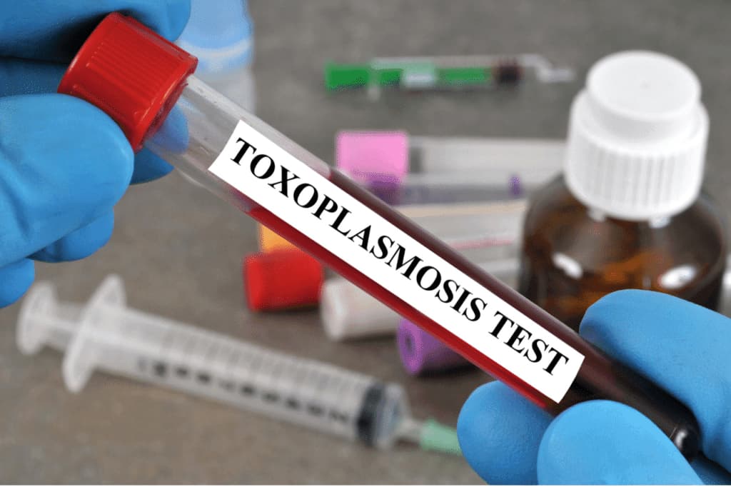toxoplasmosi